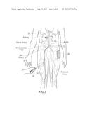 Devices, Systems and Methods for Evaluation and Feedback of     Neuromodulation Treatment diagram and image