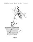 VESSEL SEALER AND DIVIDER FOR USE WITH SMALL TROCARS AND CANNULAS diagram and image