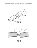 VESSEL SEALER AND DIVIDER FOR USE WITH SMALL TROCARS AND CANNULAS diagram and image