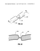 VESSEL SEALER AND DIVIDER FOR USE WITH SMALL TROCARS AND CANNULAS diagram and image