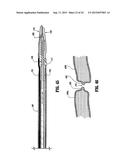 VESSEL SEALER AND DIVIDER FOR USE WITH SMALL TROCARS AND CANNULAS diagram and image