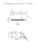 Dental Composite Dispenser For Injection Molded Filling Techniques diagram and image