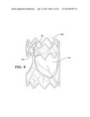 DURABLE HIGH STRENGTH POLYMER COMPOSITE SUITABLE FOR IMPLANT AND ARTICLES     PRODUCED THEREFROM diagram and image