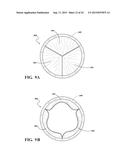 DURABLE HIGH STRENGTH POLYMER COMPOSITE SUITABLE FOR IMPLANT AND ARTICLES     PRODUCED THEREFROM diagram and image