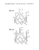 DURABLE HIGH STRENGTH POLYMER COMPOSITE SUITABLE FOR IMPLANT AND ARTICLES     PRODUCED THEREFROM diagram and image