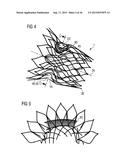 TRANSCATHETER VALVE PROSTHESIS diagram and image