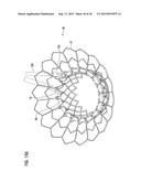 TRANSCATHETER VALVE PROSTHESIS diagram and image