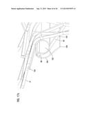 TRANSCATHETER VALVE PROSTHESIS diagram and image