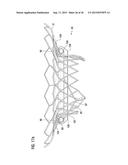 TRANSCATHETER VALVE PROSTHESIS diagram and image