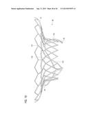 TRANSCATHETER VALVE PROSTHESIS diagram and image