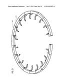 TRANSCATHETER VALVE PROSTHESIS diagram and image