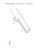 TRANSCATHETER VALVE PROSTHESIS diagram and image