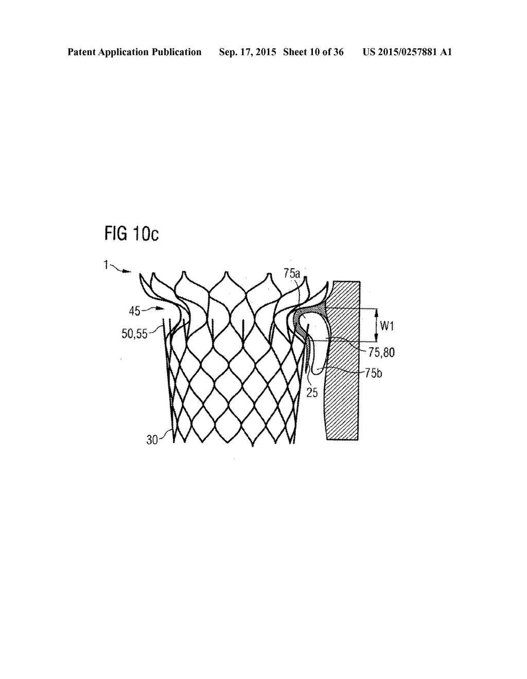 TRANSCATHETER VALVE PROSTHESIS - diagram, schematic, and image 11