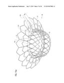 TRANSCATHETER VALVE PROSTHESIS diagram and image