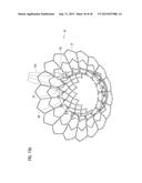 TRANSCATHETER VALVE PROSTHESIS diagram and image