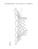 TRANSCATHETER VALVE PROSTHESIS diagram and image