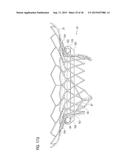 TRANSCATHETER VALVE PROSTHESIS diagram and image