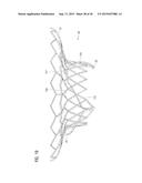 TRANSCATHETER VALVE PROSTHESIS diagram and image