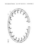 TRANSCATHETER VALVE PROSTHESIS diagram and image