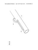 TRANSCATHETER VALVE PROSTHESIS diagram and image