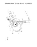 TRANSCATHETER VALVE PROSTHESIS diagram and image