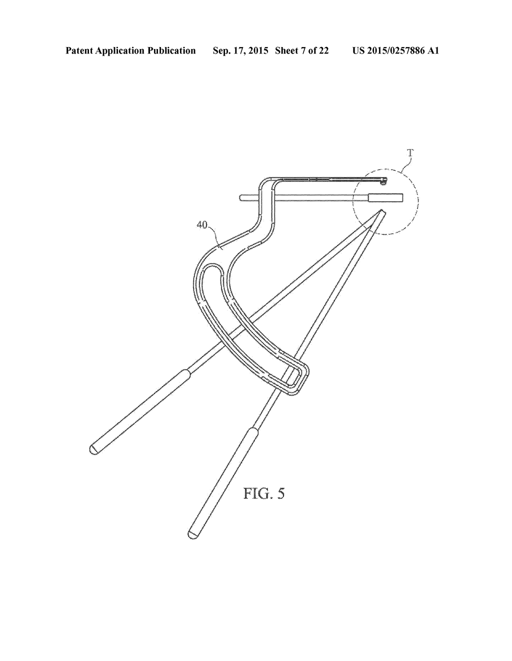 METHOD FOR TREATING JOINT PAIN AND ASSOCIATED INSTRUMENTS - diagram, schematic, and image 08