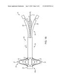 STRIPED SHEATHS FOR MEDICAL DEVICES diagram and image