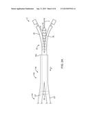 STRIPED SHEATHS FOR MEDICAL DEVICES diagram and image