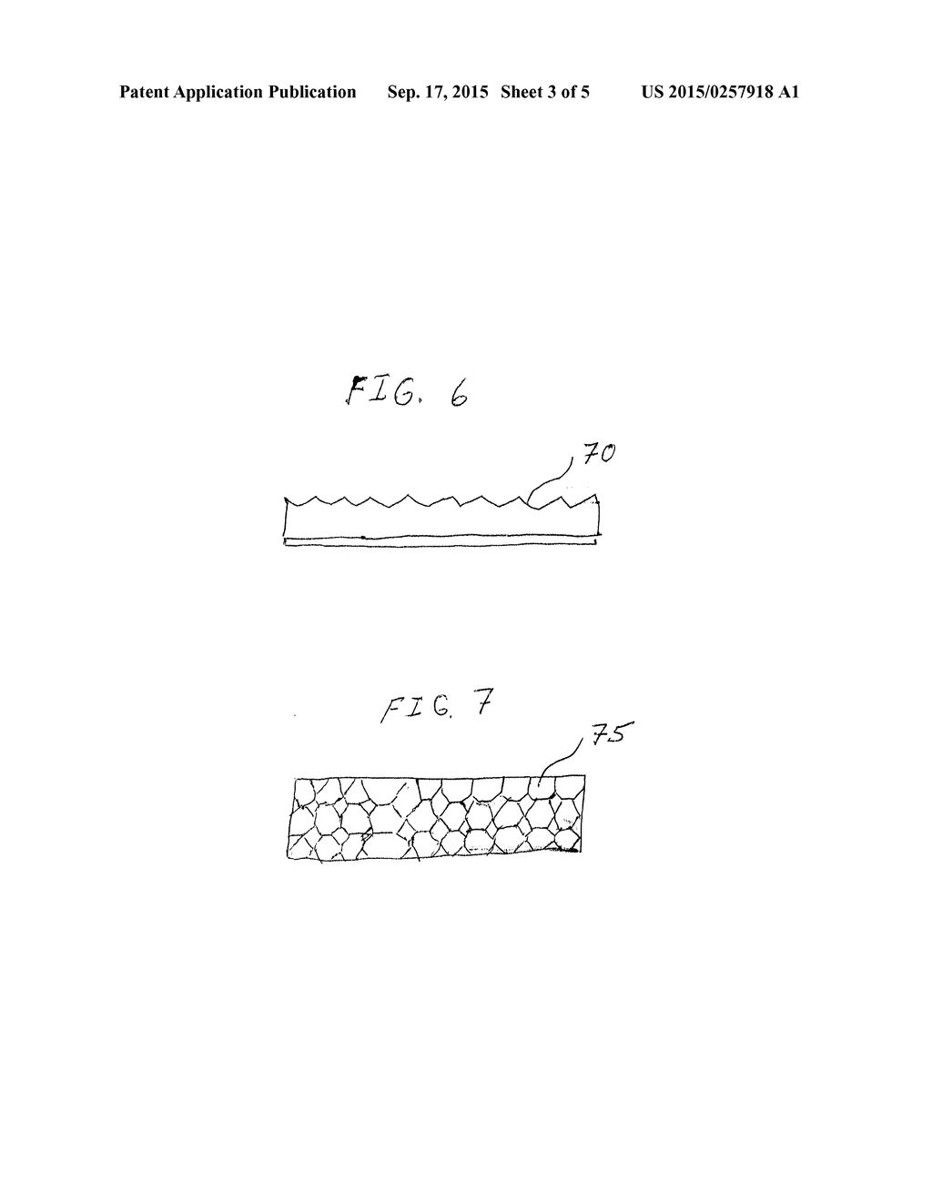 THERMOFORMABLE MEDICAL MEMBER WITH HEATER AND METHOD OF MANUFACTURING SAME - diagram, schematic, and image 04