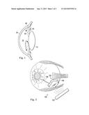 Debris Clearance System for an Ocular Implant diagram and image
