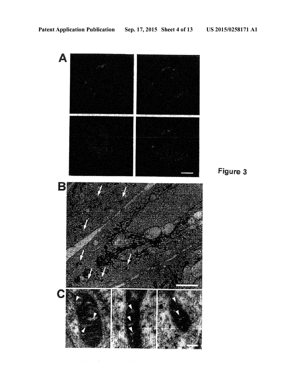 ALPHA-1-MICROGLOBULIN FOR USE IN THE TREATMENT OF MITOCHONDRIA-RELATED     DISEASES - diagram, schematic, and image 05