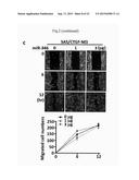 COMPOSITIONS FOR MODULATING INVASION ABILITY OF A TUMOR AND METHODS     THEREOF diagram and image