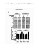 COMPOSITIONS FOR MODULATING INVASION ABILITY OF A TUMOR AND METHODS     THEREOF diagram and image