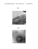 ELECTROSTATIC-BONDING-TYPE VESICLE INCLUDING METAL MICROPARTICLES diagram and image