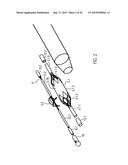 CATHETER DEVICE diagram and image