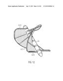 CATHETER DEVICE diagram and image