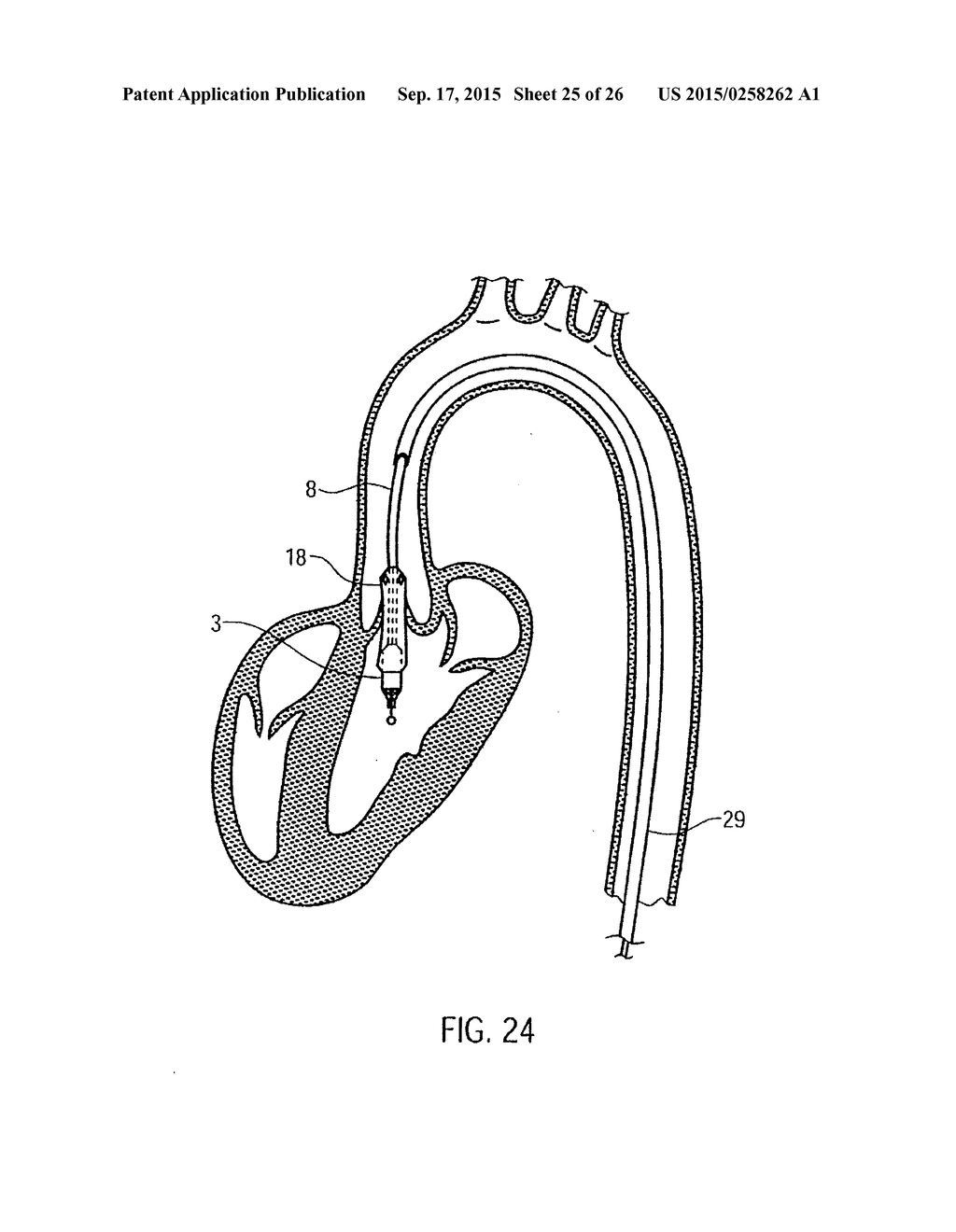 CATHETER DEVICE - diagram, schematic, and image 26