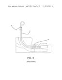 DEVICE FOR INTRODUCING AN AIRWAY TUBE INTO THE TRACHEA diagram and image