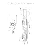 METHOD OF PERFORMING A SPHENOPALATINE GANGLION BLOCK PROCEDURE diagram and image