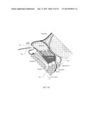 METHOD OF PERFORMING A SPHENOPALATINE GANGLION BLOCK PROCEDURE diagram and image