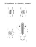 METHOD OF PERFORMING A SPHENOPALATINE GANGLION BLOCK PROCEDURE diagram and image