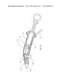 METHOD OF PERFORMING A SPHENOPALATINE GANGLION BLOCK PROCEDURE diagram and image