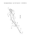 METHOD OF PERFORMING A SPHENOPALATINE GANGLION BLOCK PROCEDURE diagram and image