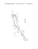 METHOD OF PERFORMING A SPHENOPALATINE GANGLION BLOCK PROCEDURE diagram and image