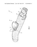 VASCULAR ACCESS PORT SYSTEMS AND METHODS diagram and image