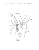 VASCULAR ACCESS PORT SYSTEMS AND METHODS diagram and image