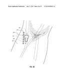 VASCULAR ACCESS PORT SYSTEMS AND METHODS diagram and image