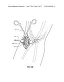 VASCULAR ACCESS PORT SYSTEMS AND METHODS diagram and image