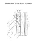 VASCULAR ACCESS PORT SYSTEMS AND METHODS diagram and image