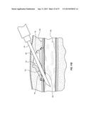 VASCULAR ACCESS PORT SYSTEMS AND METHODS diagram and image